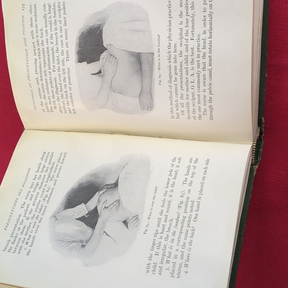 Antique 1915 Obstetrics For Nurses Book - Picture 12 of 13